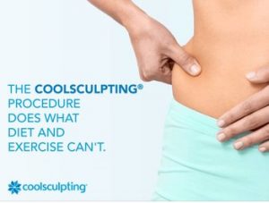Coolsculpting - How to lose fat over the back